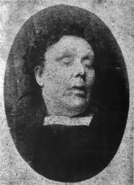 Mortuary photograph of Annie Chapman